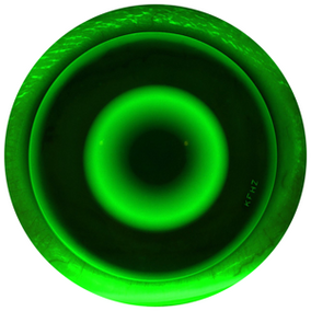 Bespoke custom-designed OrthoK lenses