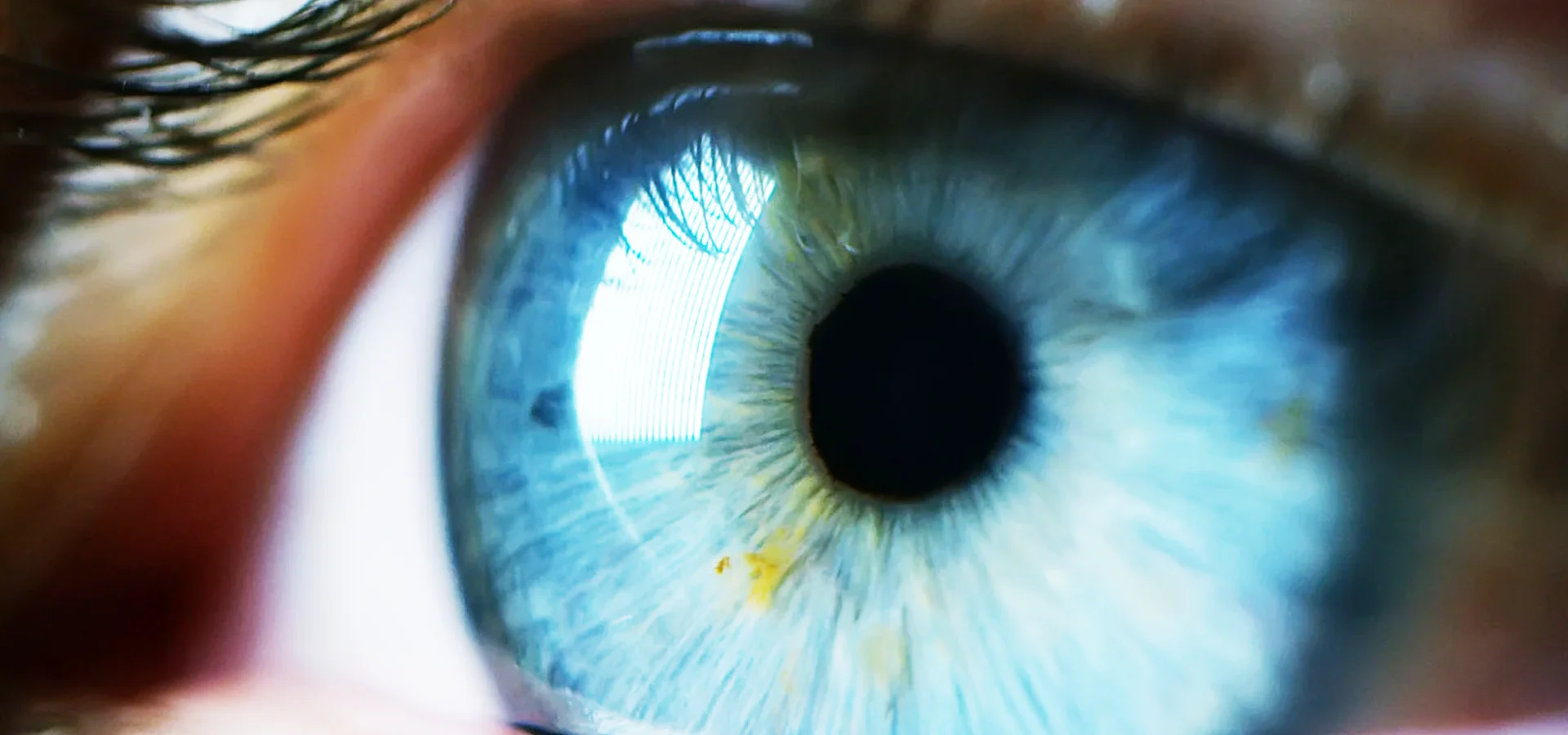 Person rubbing their eyes due to dry eye discomfort