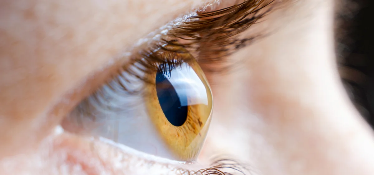 Corneal topography assessment for keratoconus at Eyecare Concepts Melbourne